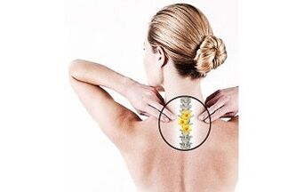 emakakaela osteokondroos naistel