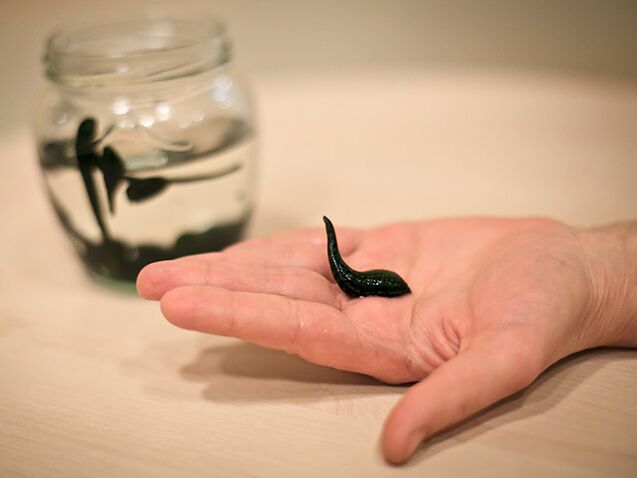 rakendus põlveliigese artroosi raviks